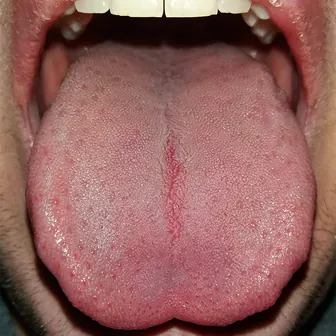 tongue